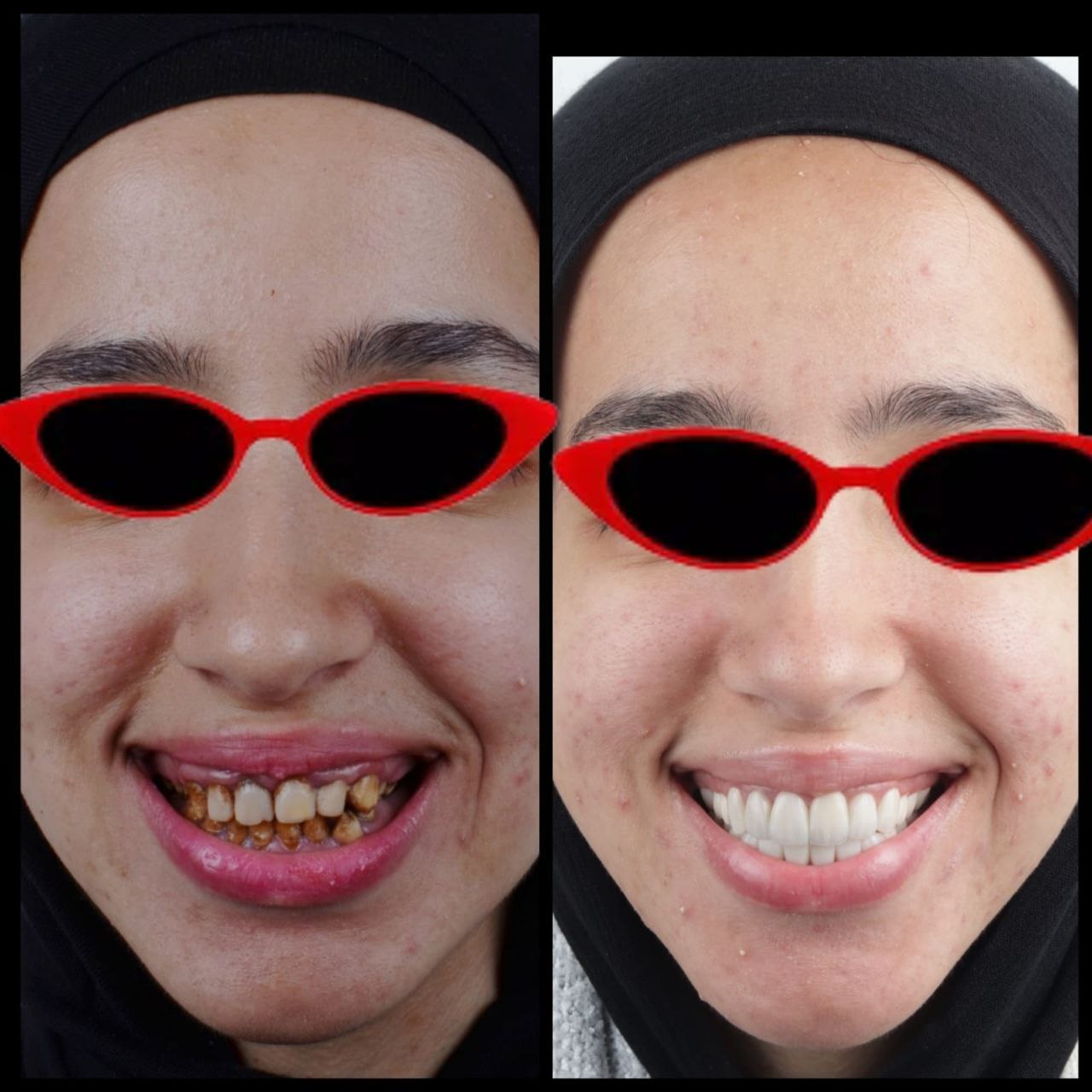 إعادة تأهيل الفك 1